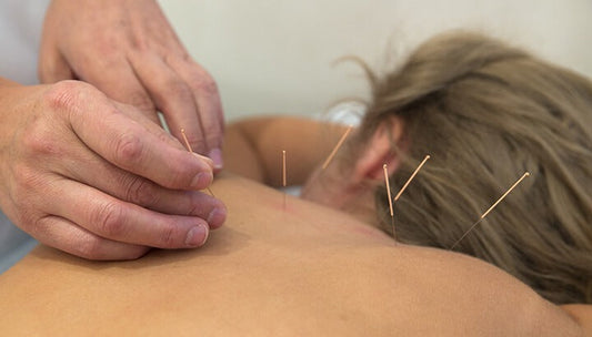 Acupuncture For Pain